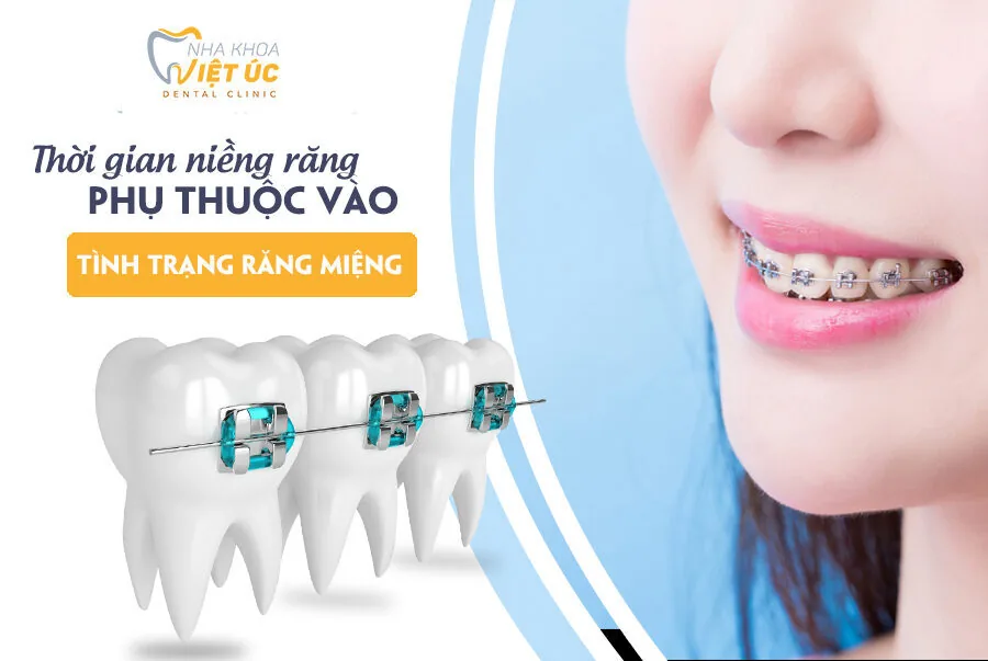 thoi gian nieng rang phu thuoc vao tinh trang rang mieng