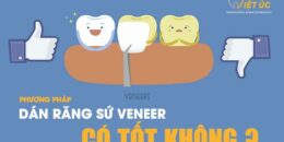 Dán răng sứ veneer có tốt không? Nha khoa Việt Úc