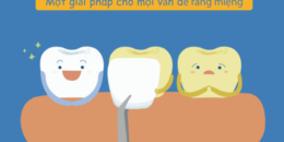 Cảnh báo hậu quả của bọc răng sứ hỏng – Những biến chứng không thể ngờ