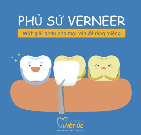 dan su veneer