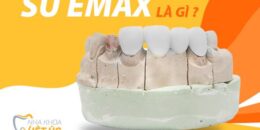 Tìm hiểu về răng sứ Emax Veneer là gì?