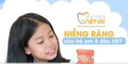 Kiến thức về niềng răng cho trẻ em các bậc phụ huynh nên biết