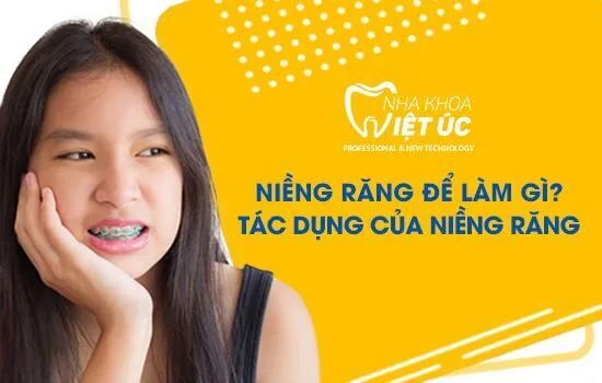 Niềng răng để làm gì