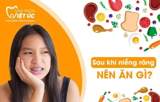 Sau khi niềng răng bạn nên ăn gì? Sau khi niềng răng bạn nên ăn gì?