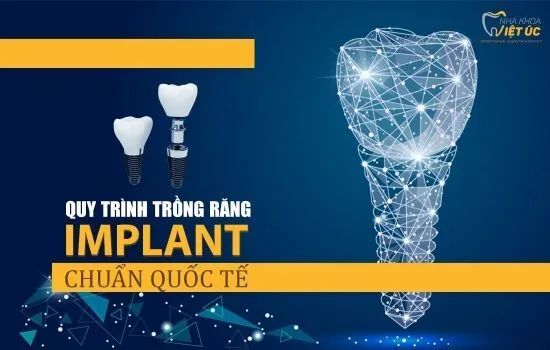 quy-trinh-trong-rang-implant-chuan-quoc-te