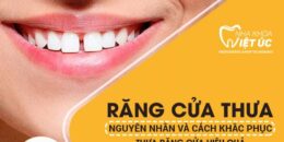 Răng cửa thưa – Nguyên nhân và cách khắc phục thưa răng cửa hiệu quả