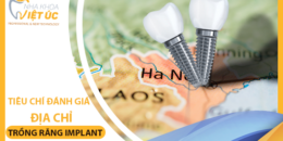 Tổng hợp 4 tiêu chí đánh giá địa chỉ trồng răng Implant uy tín tại Hà Nội