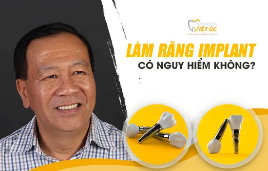Làm-răng-Implant-có-nguy-hiểm-không