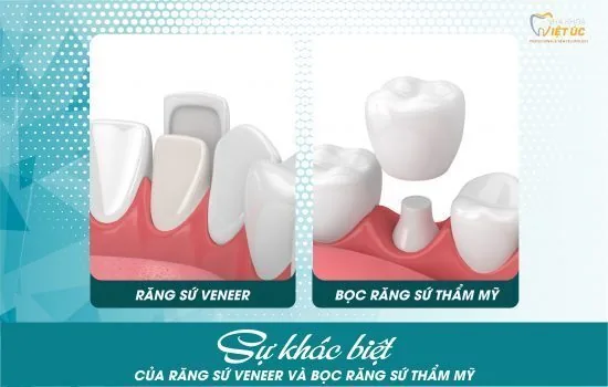 SU KHAC BIET CUA DAN SU VA BOC SU -02