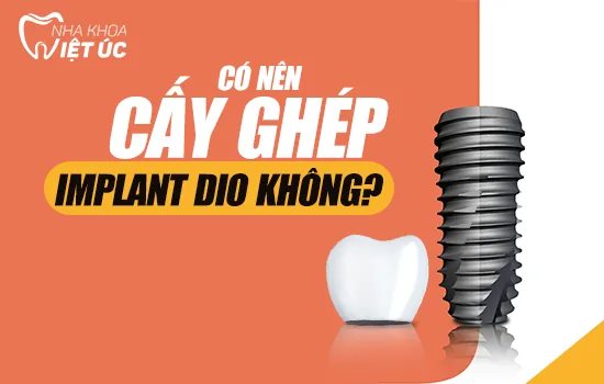 co nen cay ghep Implant Dio khong