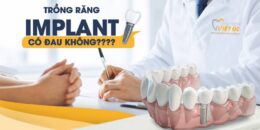 Trồng răng hàm có đau không? Nên trồng răng bằng phương pháp nào?
