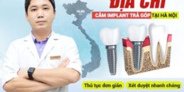 Địa chỉ cắm Implant trả góp tại Hà Nội