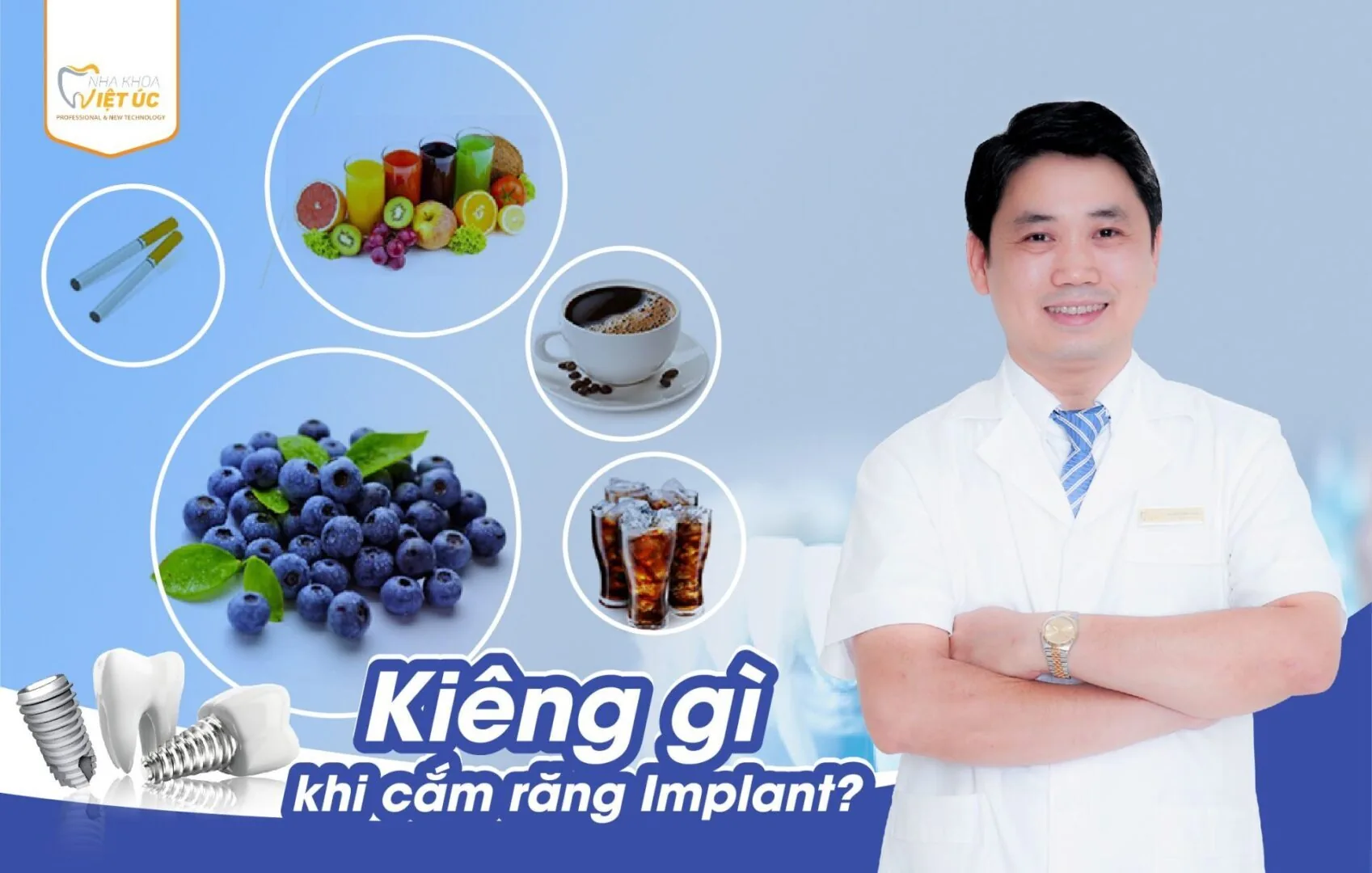 kieng gi khi cam rang Implant
