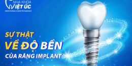 Trồng răng implant có bền không?