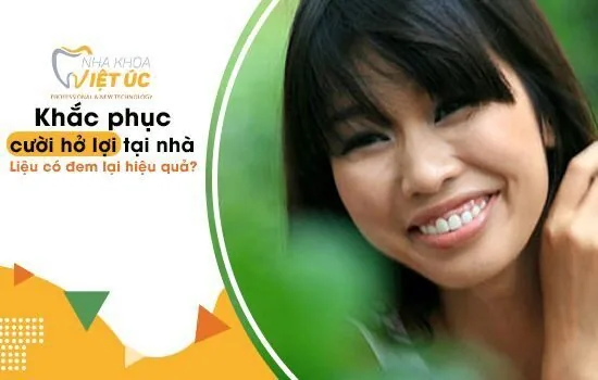 Chữa cười hở lợi tại nhà có hiệu quả không?