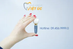 female-hand-holding-tooth-implant-false-tooth-tooth-human-implant-dental-concept-human-teeth-dentures_85672-811
