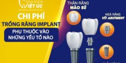 Chi phí trồng răng Implant phụ thuộc vào yếu tố nào?