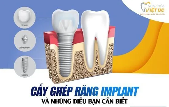 z1557291260977_4ba287d3ea066e636a4805ec6e34541b