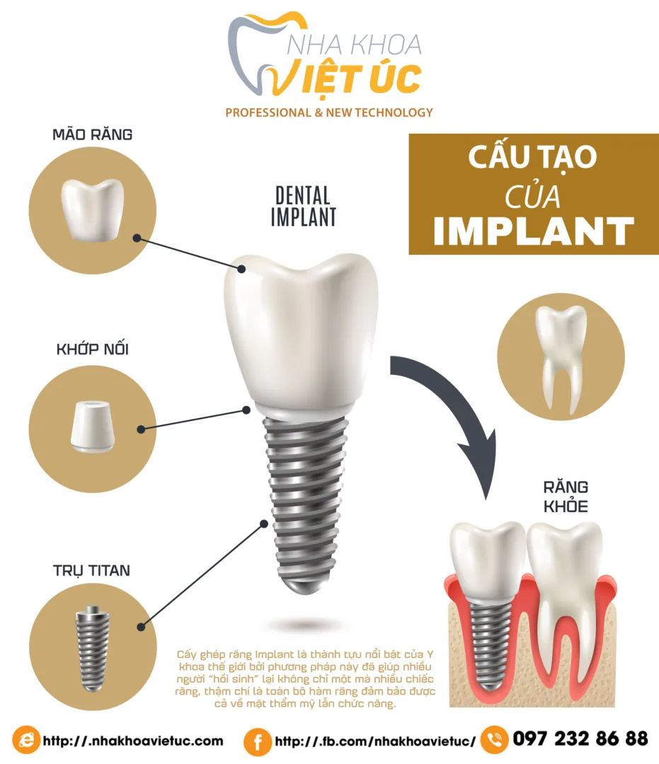 TRU-IMPLANT-1