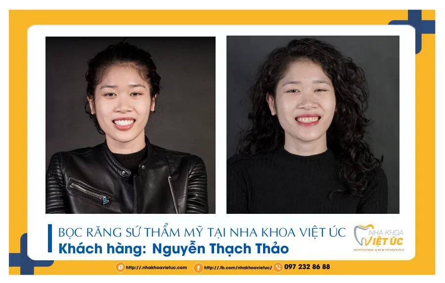 anh-nha-khoa-viet-uc-75