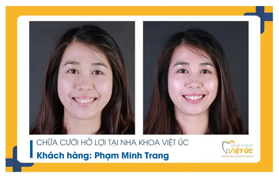 anh-nha-khoa-viet-uc-75