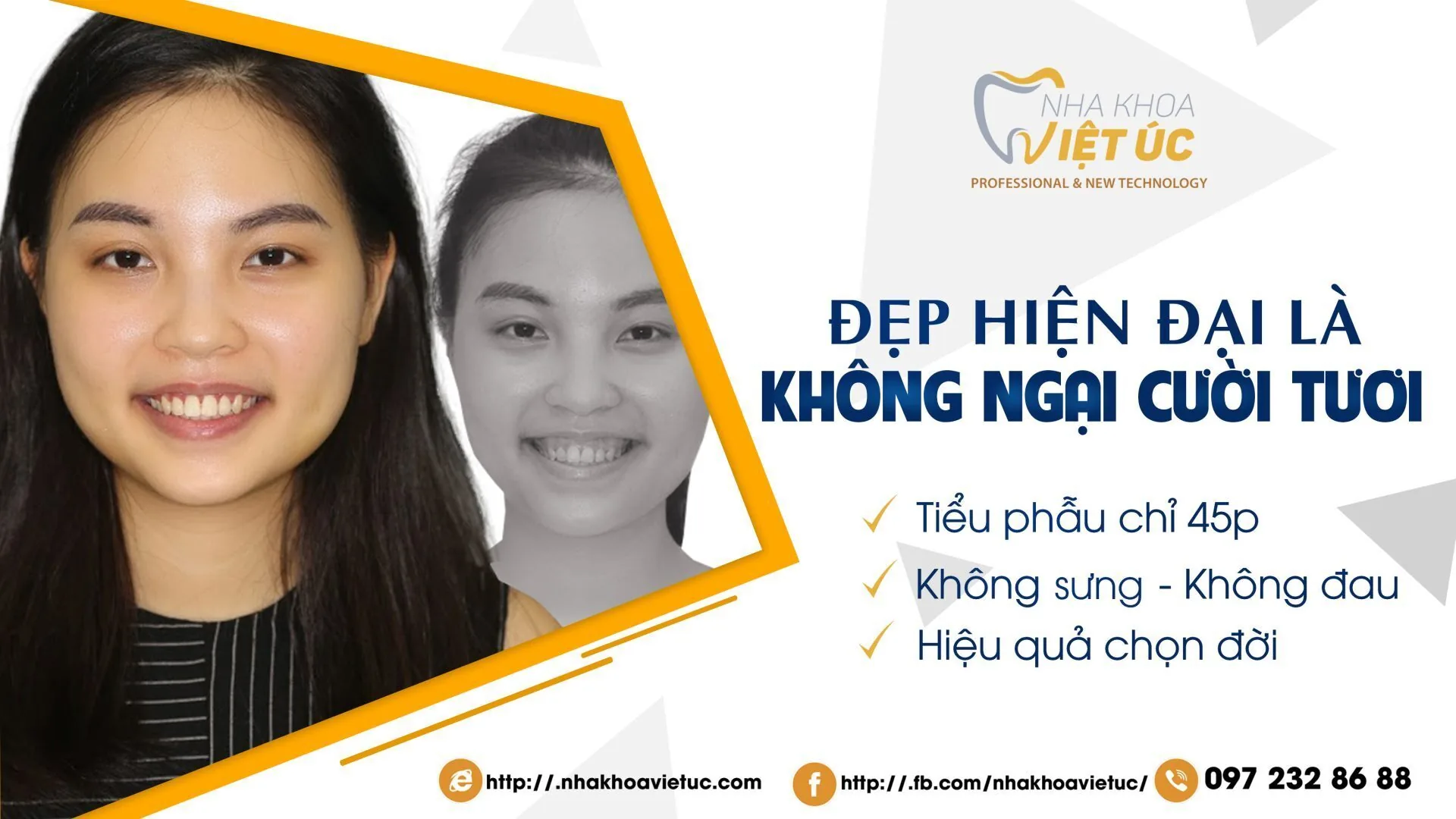 lot-xac-nu-cuoi-rang-dep-nhu-sao-2