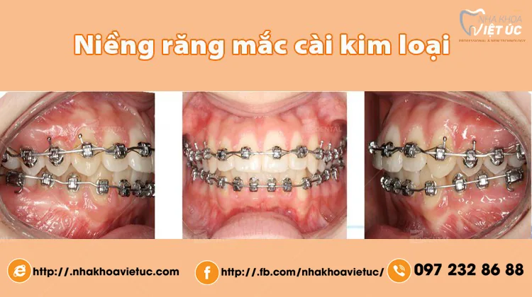 d3309b6c88744ecd444aebfe2df569cf
