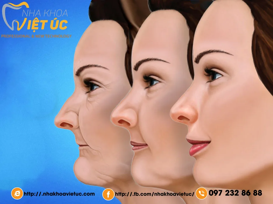 NHỮNG LỢI ÍCH KHI TRỒNG RĂNG IMPLANT MÀ CÁC BẠN NÊN BIẾT