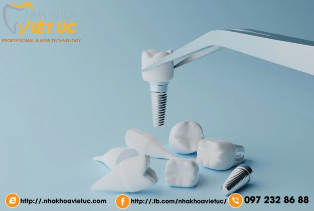 NHỮNG LỢI ÍCH KHI TRỒNG RĂNG IMPLANT MÀ CÁC BẠN NÊN BIẾT