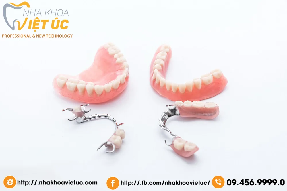 Hàm giả tháo lắp