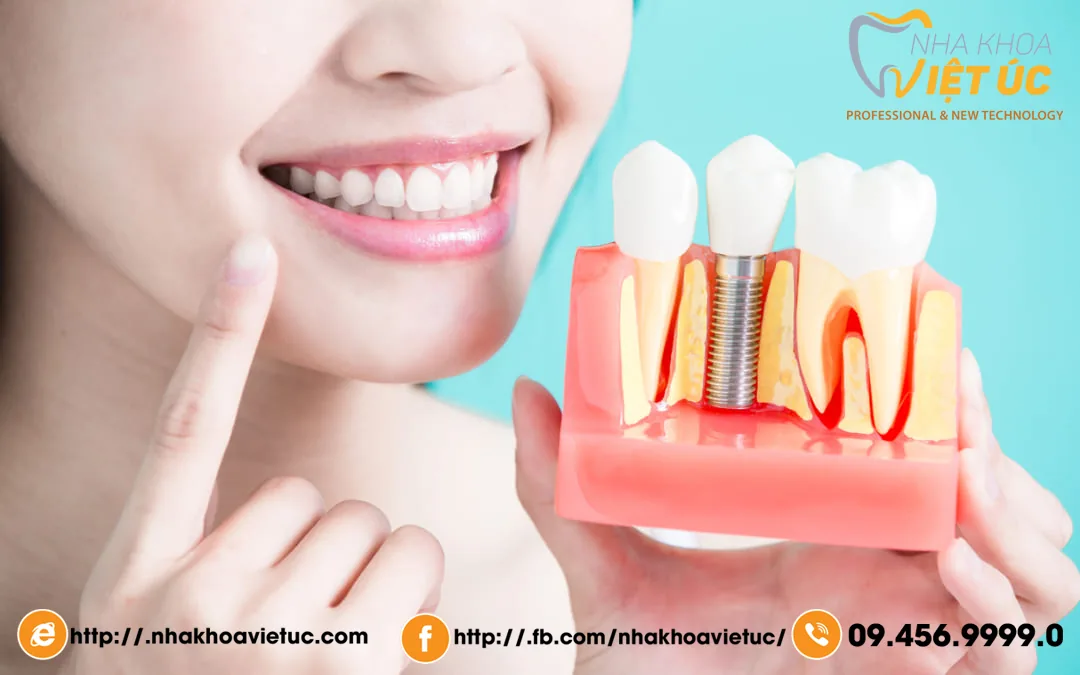 trong-rang-implant-co-nguy-hiem-khong-1080x675