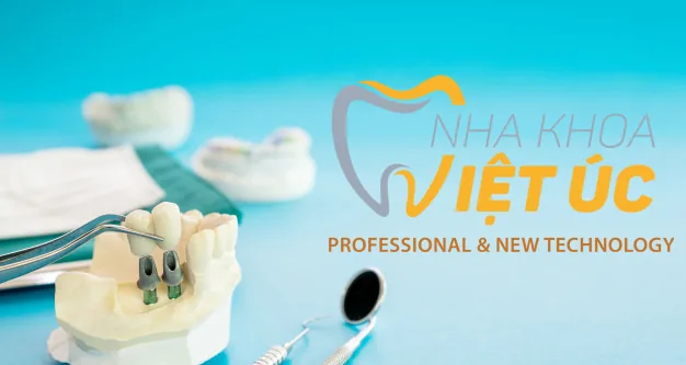 NHỮNG LỢI ÍCH KHI TRỒNG RĂNG IMPLANT MÀ CÁC BẠN NÊN BIẾT