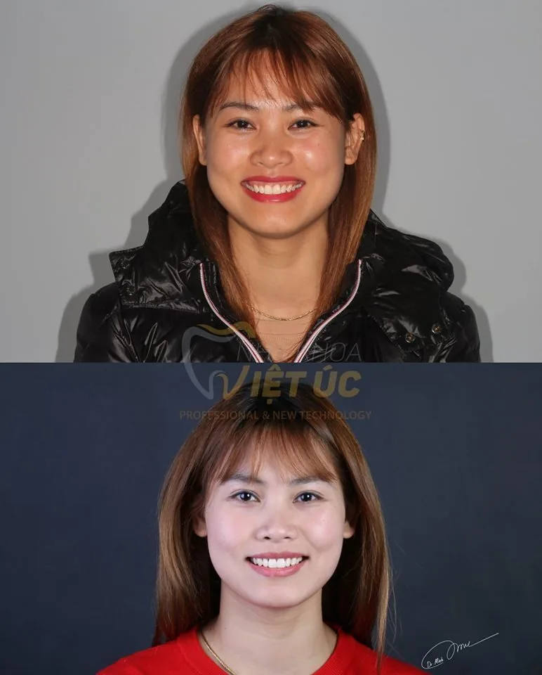 Nha khoa Việt Úc