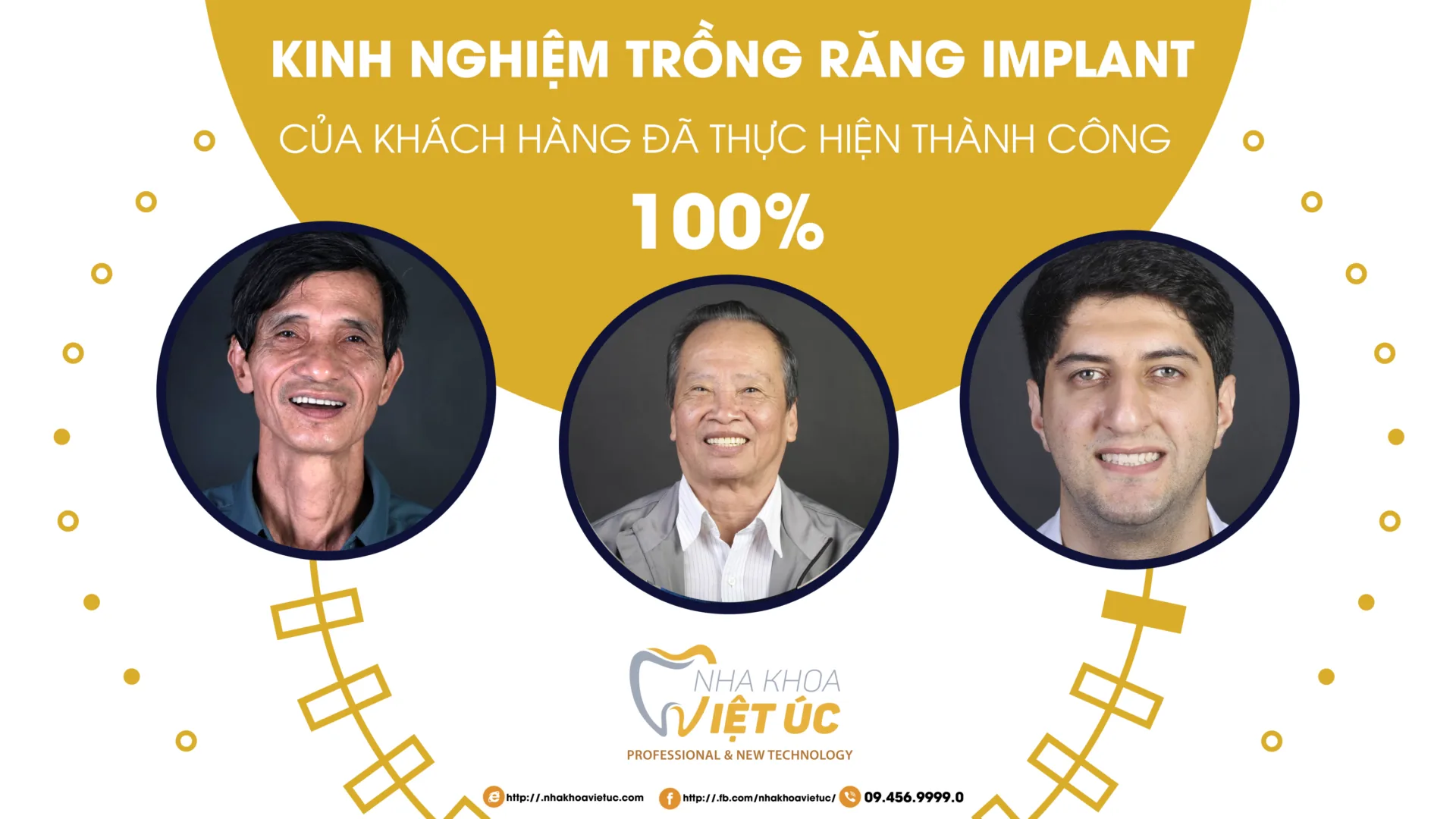 kinh nghiệm trồng răng của khách hàng đã thực hiện thành công