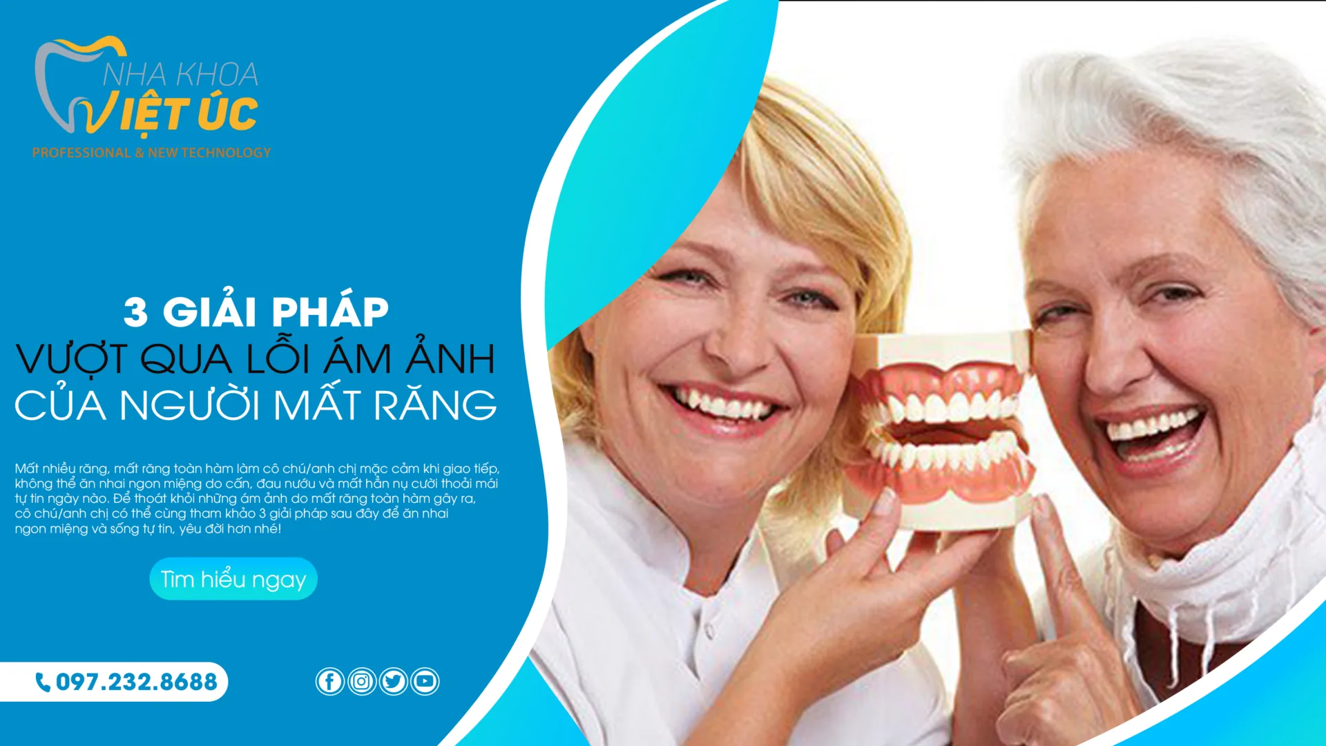 nha khoa việt úc 3 GIẢI PHÁP GIÚP NGƯỜI MẤT RĂNG THOÁT KHỎI ÁM ẢNH MẤT RĂNG TOÀN HÀM 1