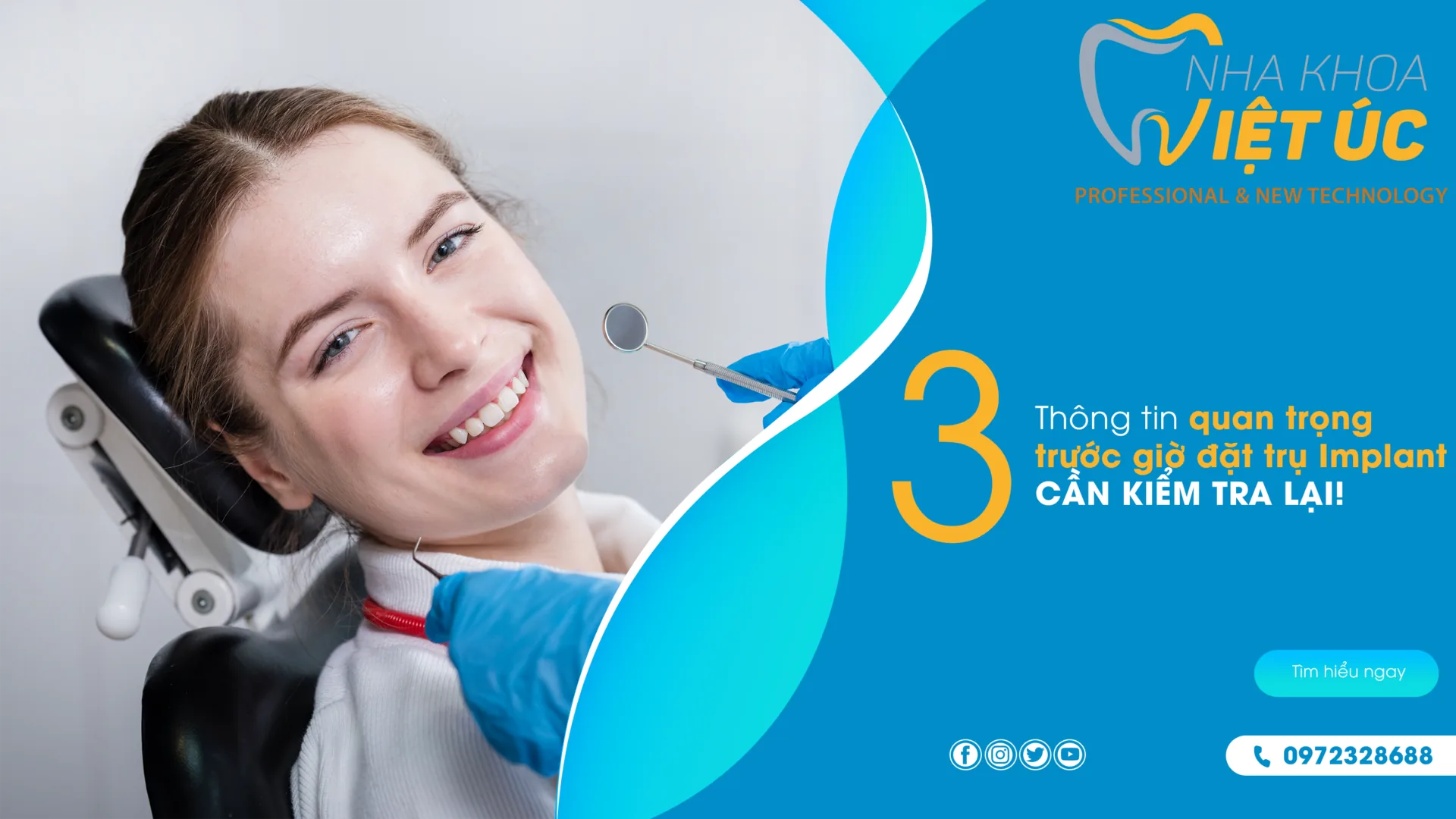 3 THÔNG TIN QUAN TRỌNG TRƯỚC GIỜ ĐẶT TRỤ IMPLANT CẦN KIỂM TRA LẠI