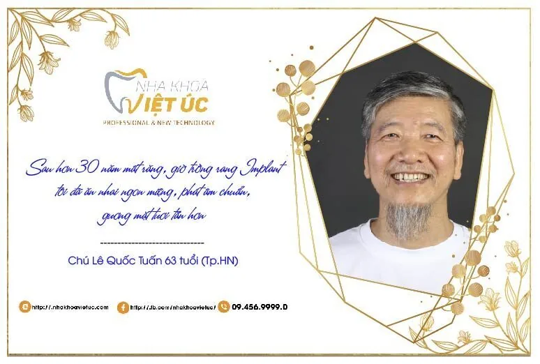 khách hàng nha khoa việt úc chia sẻ bí quyết lấy lại nụ cười tự tin