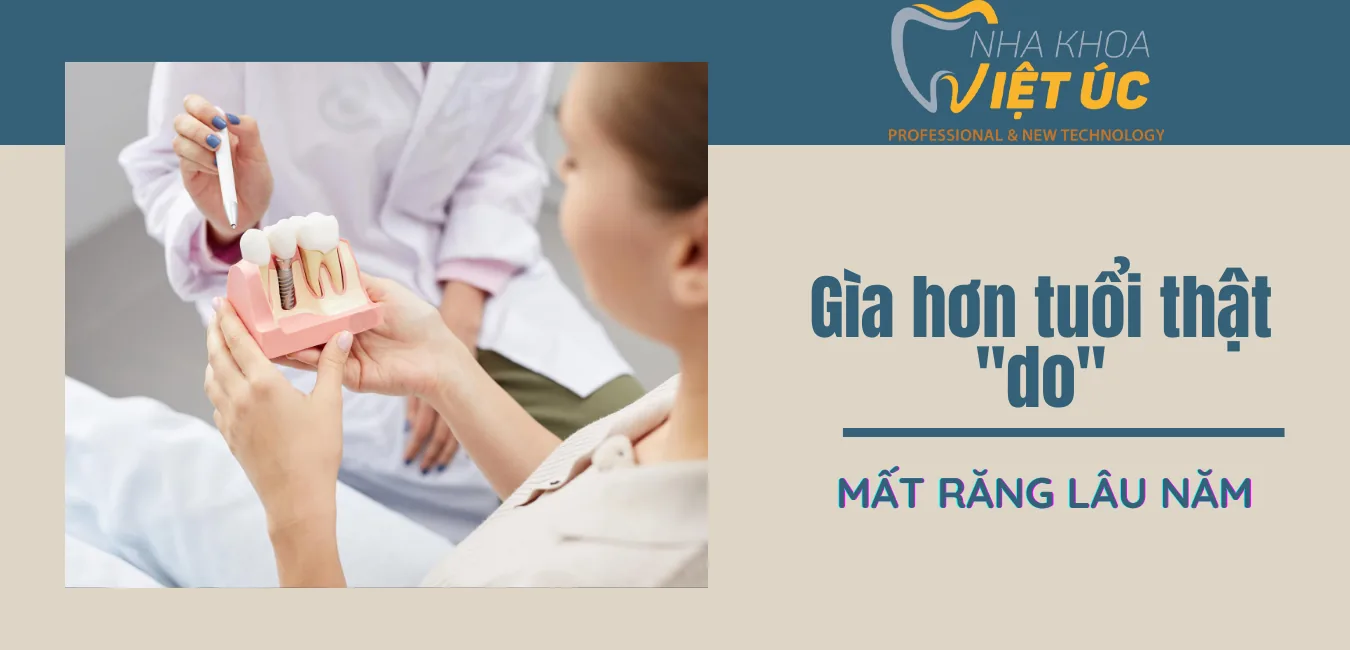 già hơn tuổi thật do mất răng lâu năm