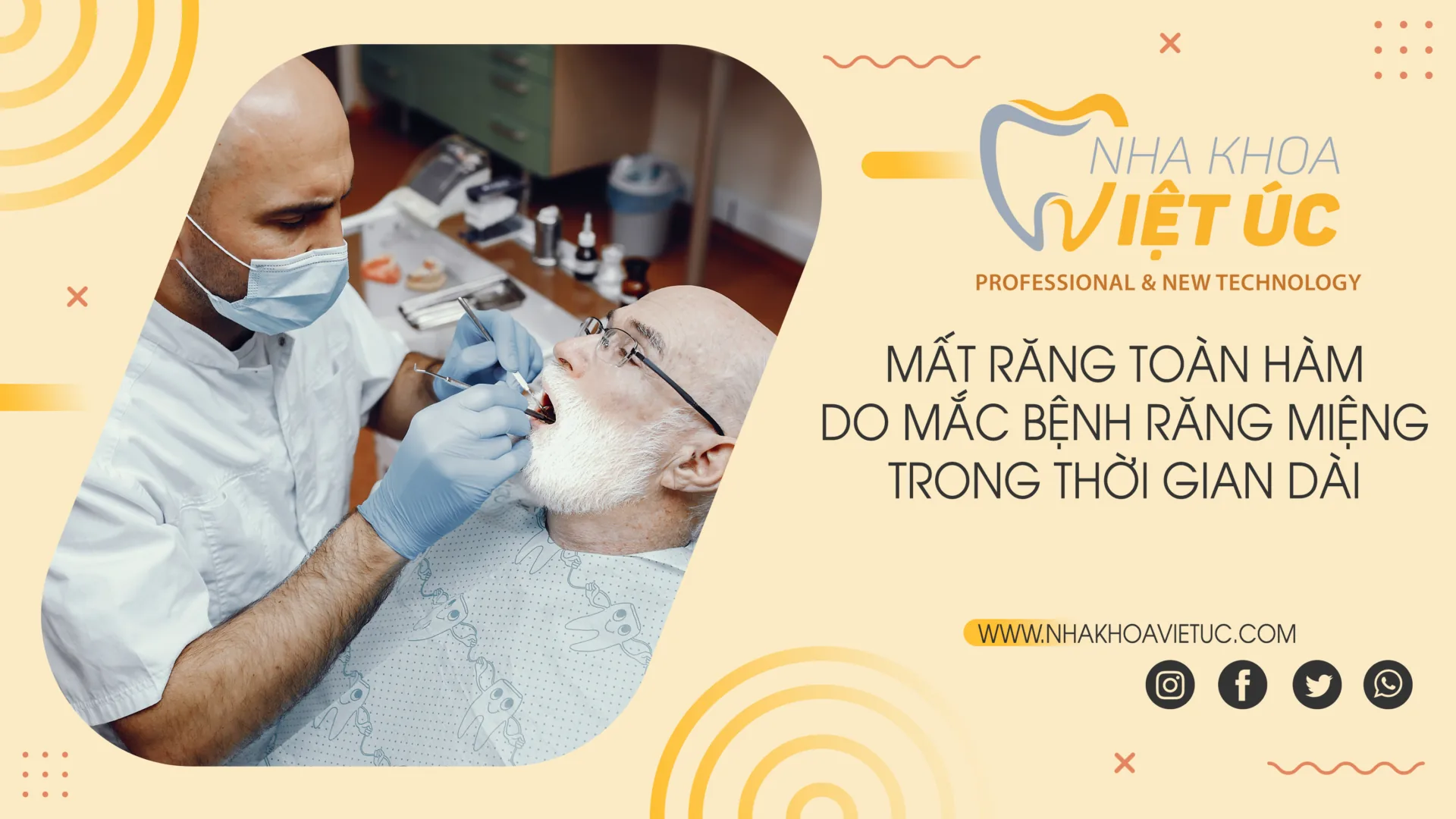 mất răng toàn hàm do bệnh răng miệng trong thời gian dài