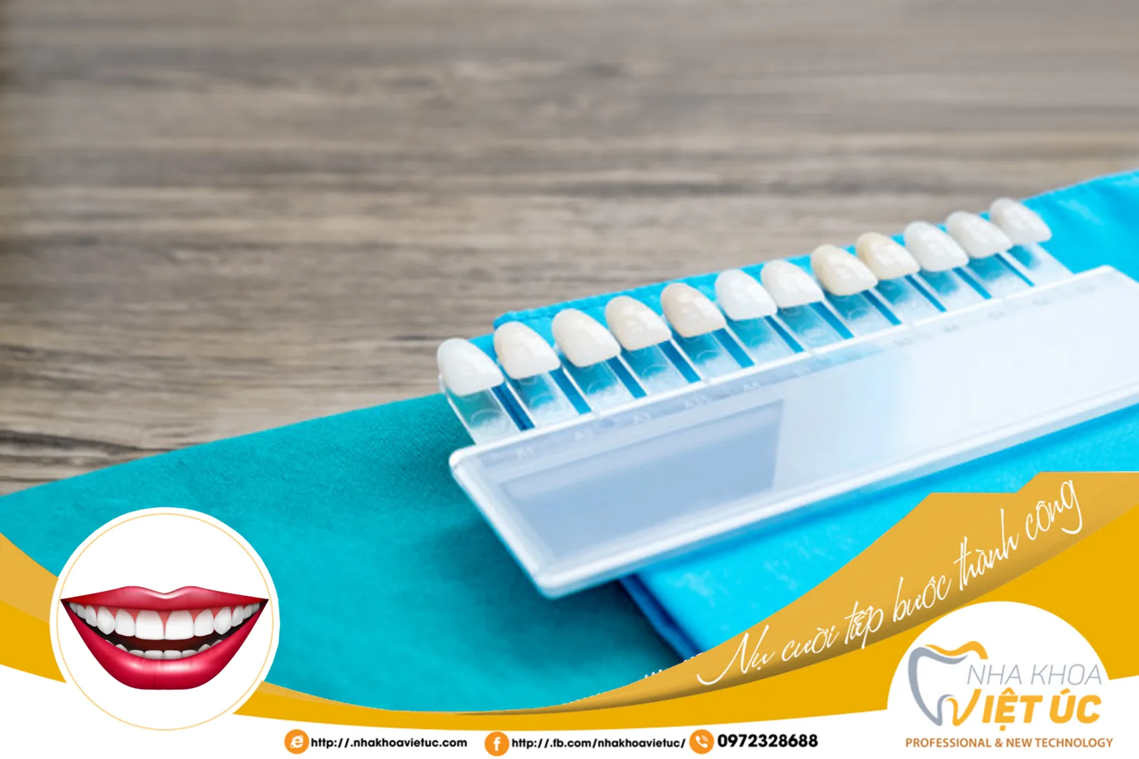 Mặt dán sứ rất mỏng