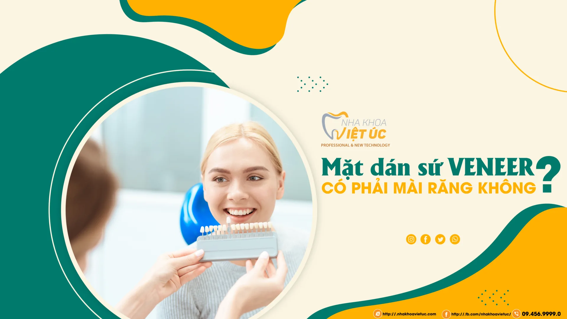 làm dán sứ veneer có phải mài răng không