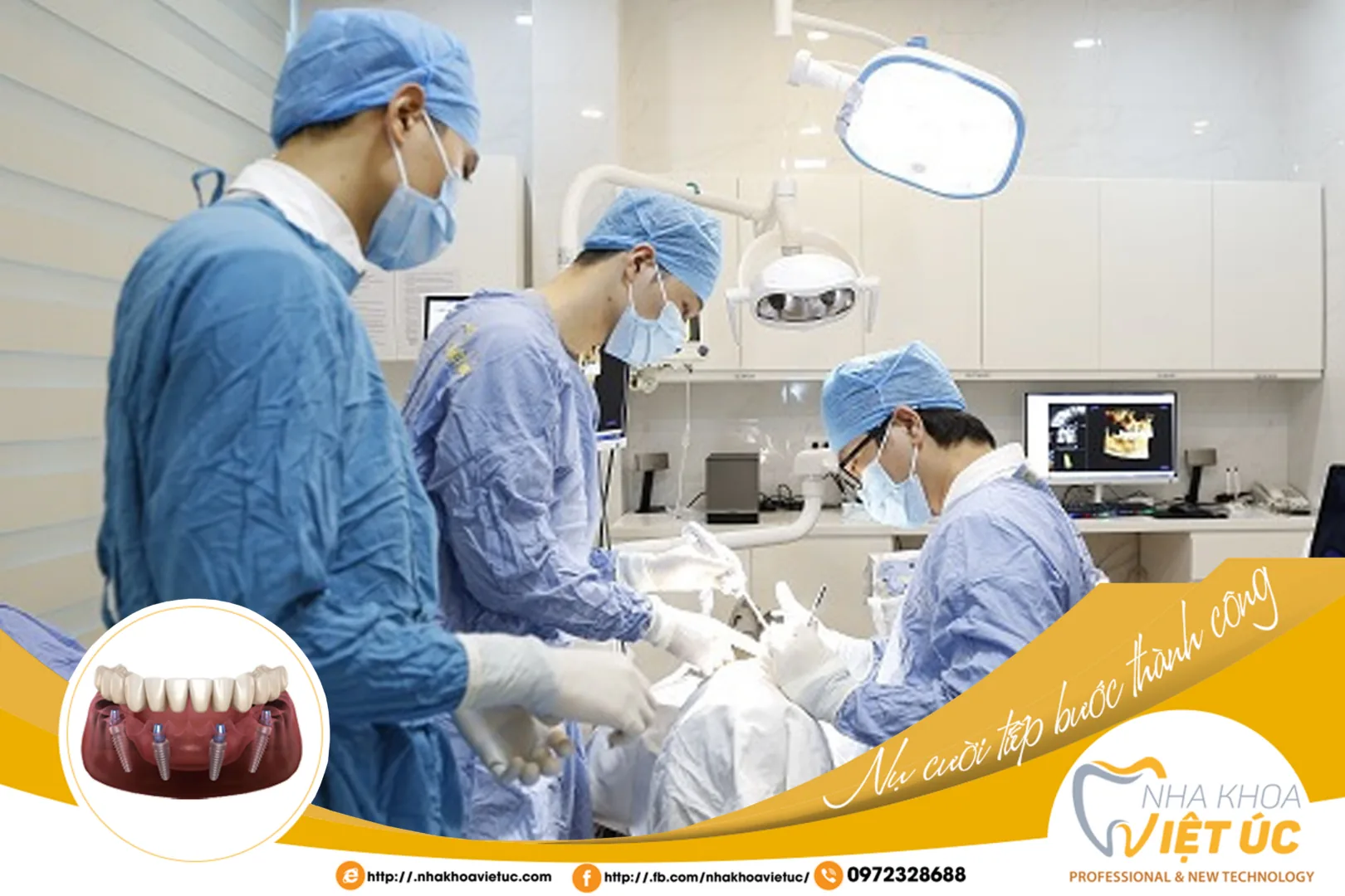 CHỌN NHA KHOA CÓ KINH NGHIỆM TRỒNG RĂNG IMPLANT LÂU NĂM VÀ CÓ TỈ LỆ TRỒNG RĂNG THÀNH CÔNG CAO NHẤT