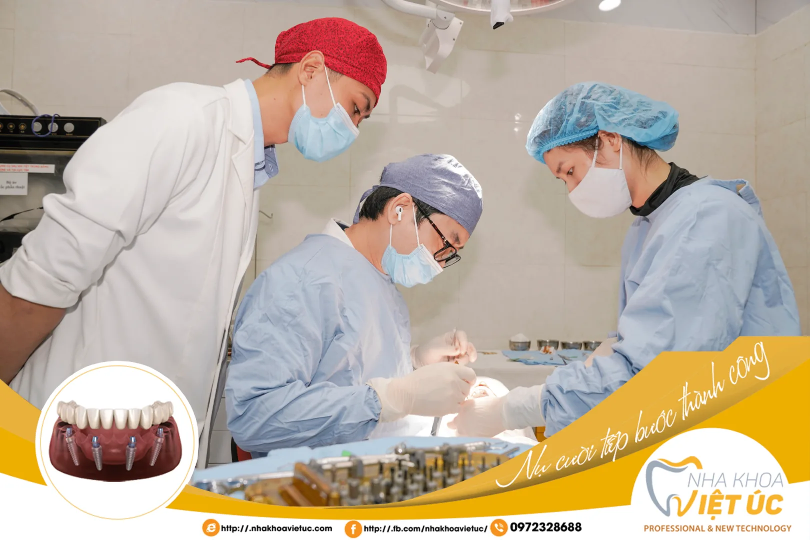 các bác sĩ tại Nha khoa Việt Úc đã thưc hiện thành công hàng ngàn ca trồng răng Implant