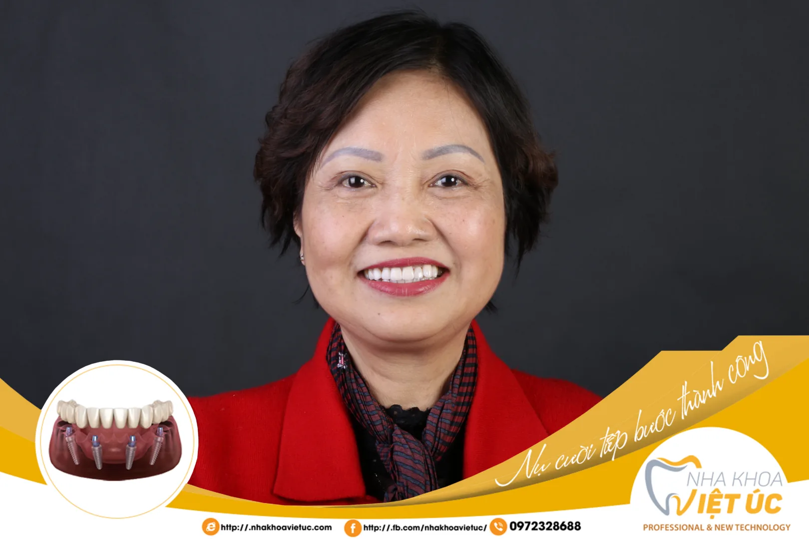 TRỒNG RĂNG IMPLANT CÓ ĐI ĐƯỢC MÁY BAY KHÔNG