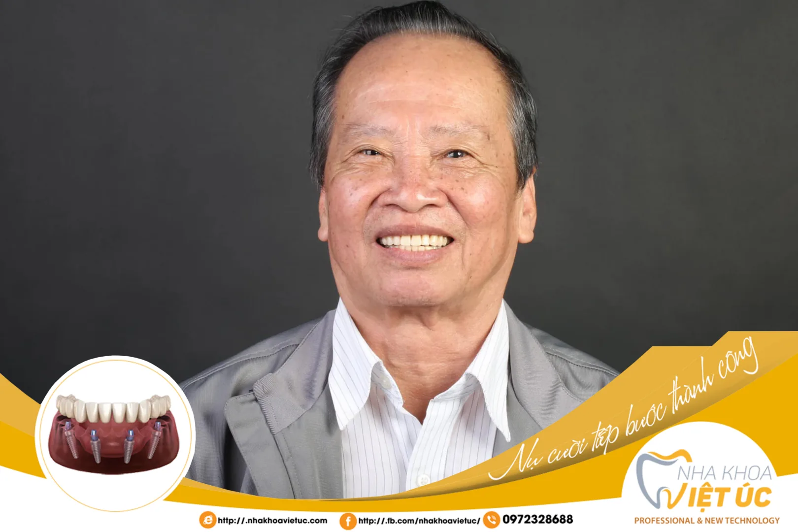 TRỒNG RĂNG IMPLANT GIÚP CẢI THIỆN TÌNH TRẠNG TIM MẠCH