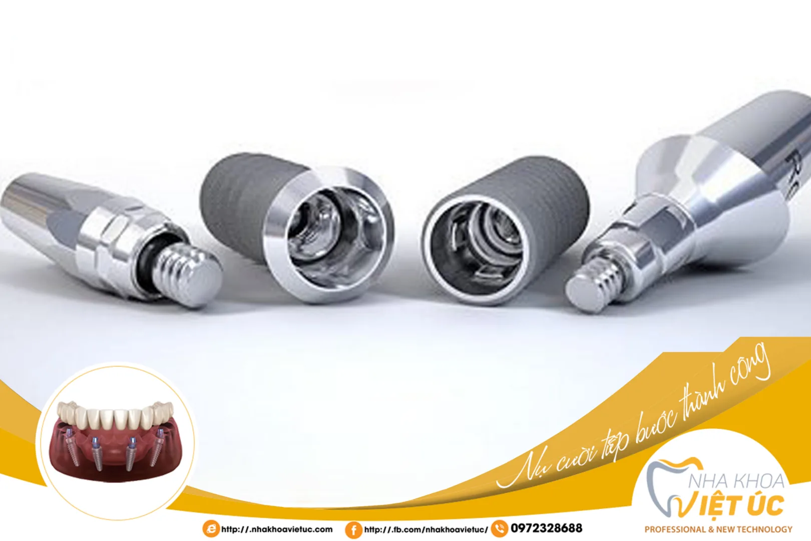 Trụ Implant được chế tạo từ hợp chất titanium có đặc tính sinh học đặc biệt nên có thể tích hợp vững chắc với xương hàm