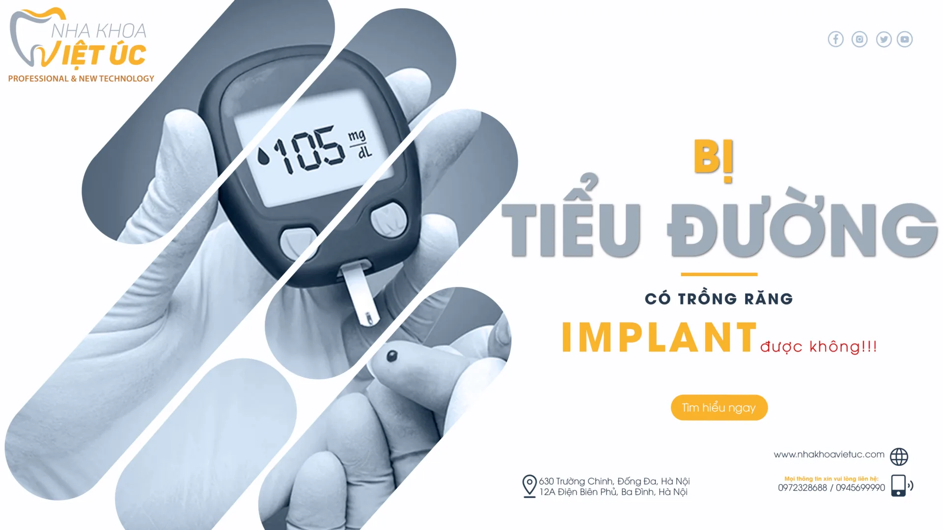 bị tiểu đường có trồng răng implant được không