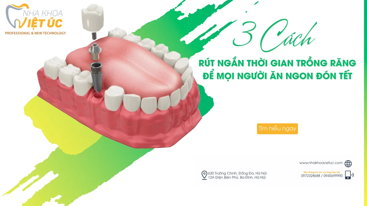 3 cách trồng răng nhanh nahast để đón tết