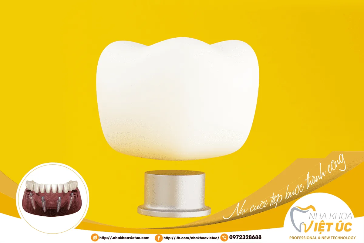 Mão răng sứ đóng vai trò như thân răng giúp lấy lại thẩm mỹ hài hòa và chịu lực ăn nhai vững chắc