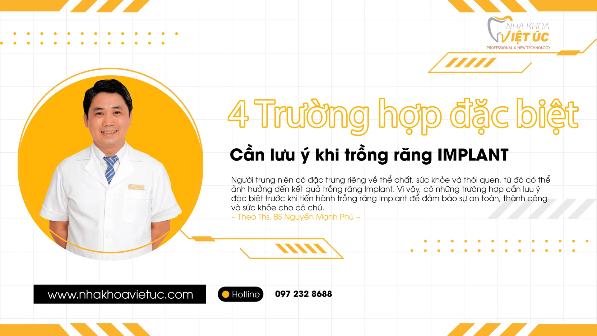 4 trường hợp đặc biệt cần lưu ý khi trồng răng implant